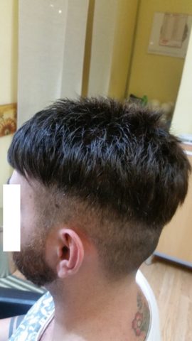 protesi capelli uomo roma