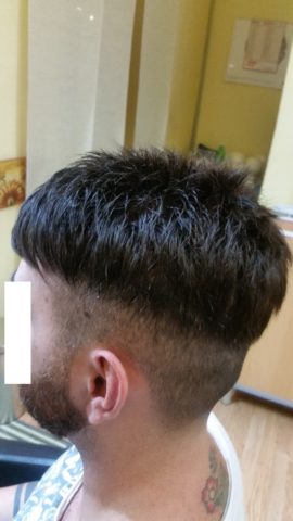 protesi per capelli roma